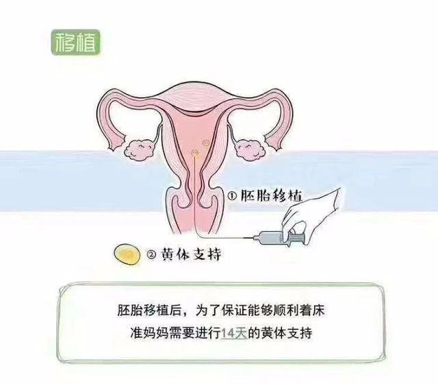 (七)胚胎移植